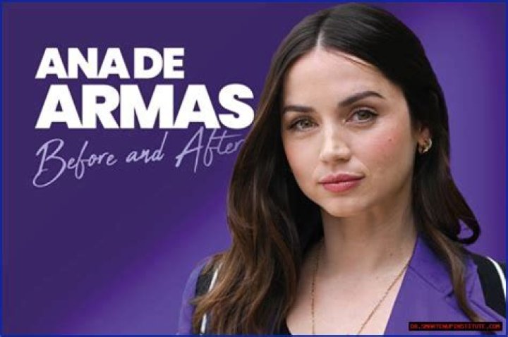 Ana De Armas Plastic Surgery Exposed