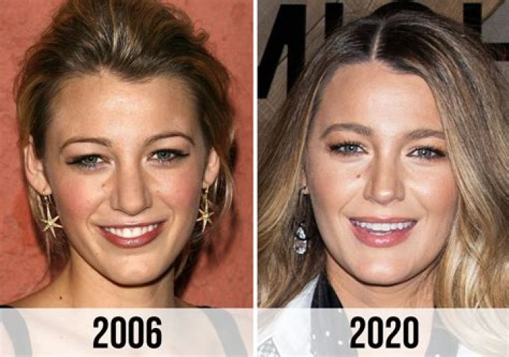Blake Lively before and after the rumoured nose job she's never admitted to |