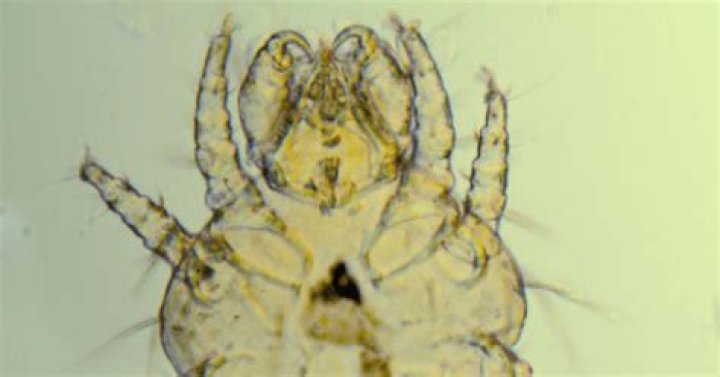 Cheyletiella Mite Bites On Humans Unveiled!
