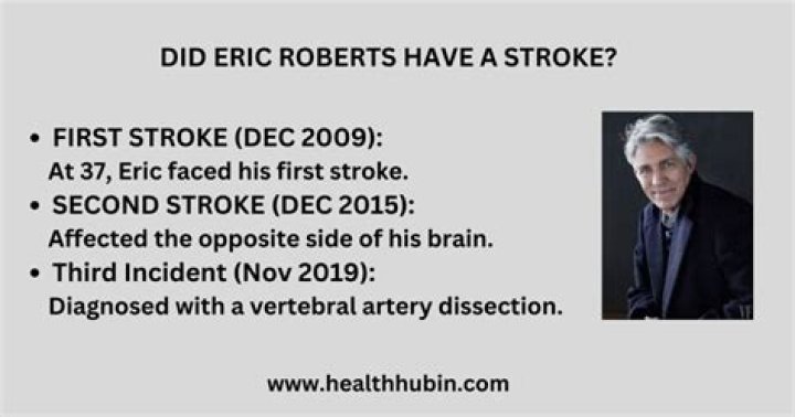Did Eric Roberts Suffer A Stroke?