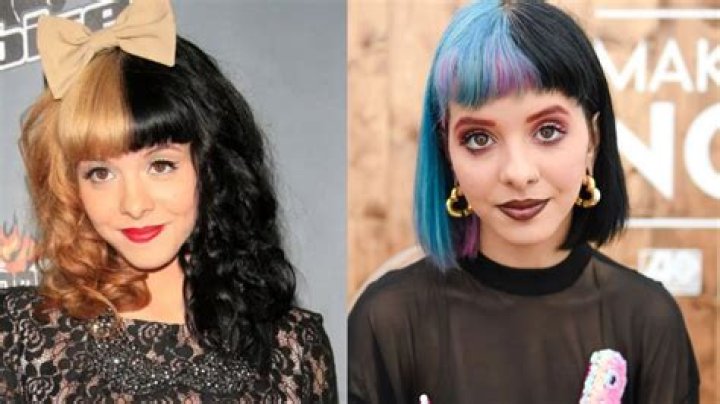 Did Melanie Martinez Get Surgery?