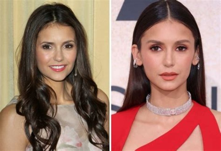 Did Nina Dobrev Get Plastic Surgery? Debunking The Rumors |