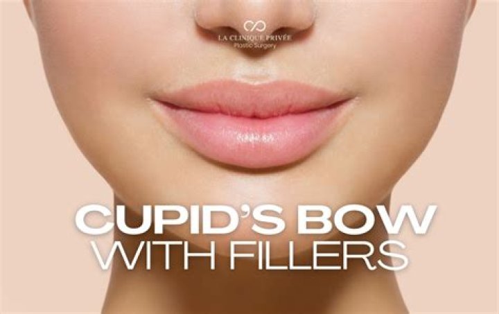 Discover The Enchanting Allure Of Cupid's Bow Lips