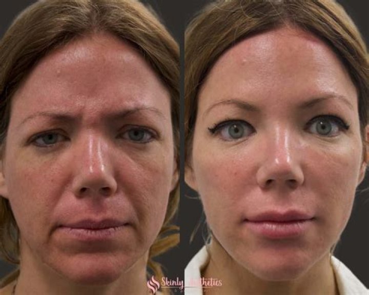 Farrah Abraham Gets Botox and Face Fillers After Her Arrest ·
