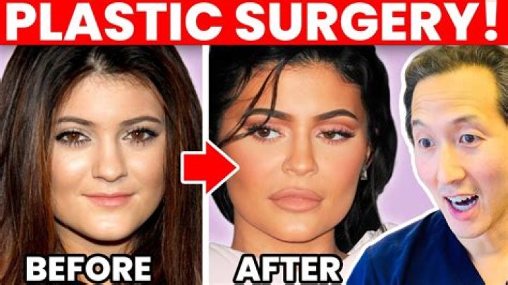 Has Bianca Censori Had Plastic Surgery? Who is Bianca Censori?