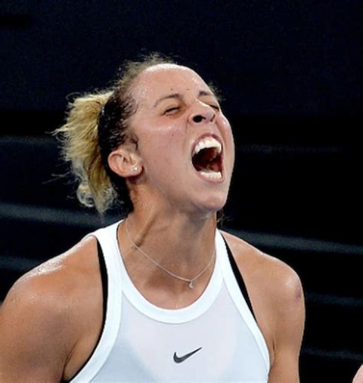 Madison Keys Teeth The Tennis Star Responds