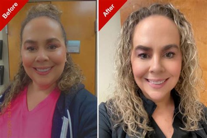Molly Hurwitz Weight Loss Before And After: Matthew Perry Ex-Fiancee Health 2023