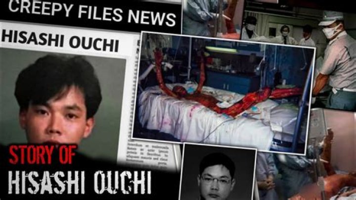 The Haunting Truth: Hisashi Ouchi's Autopsy