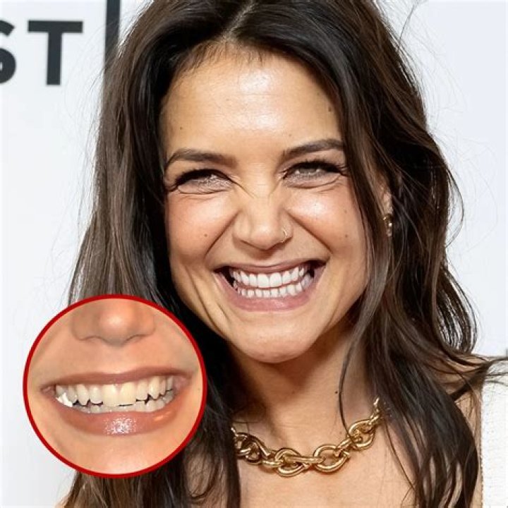 The Ugly Truth: Celebrities with Bad Teeth