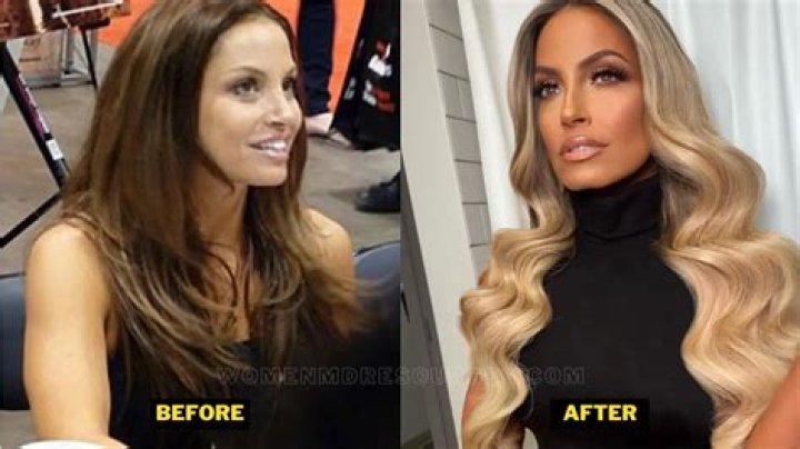 Trish Stratus Plastic Surgery: Before and After Photos