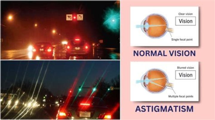 Unveiling The Secrets Of Night Driving With Astigmatism: Eye-Opening Insights
