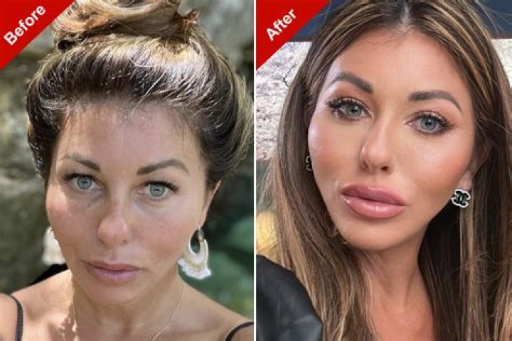 What Cosmetic Surgery Did Jules From Ms. Undergo? Unraveling The Gossip