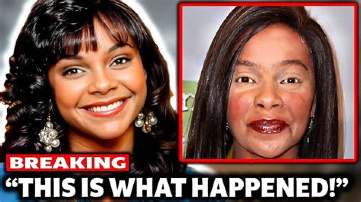 What Happened To Lark Voorhies' Face?